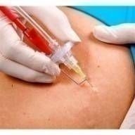 Ares Carboxiterapia Com Gás Aquecido e Corrente High Volt - Ibramed